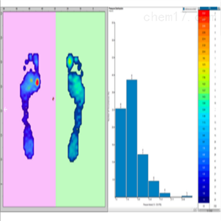 足底壓力測試系統(tǒng)